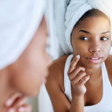 Skincare Routine For Acne-Prone Skin - Nirvana Natural Bliss Luxury Skincare