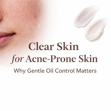 Clear Skin for Acne-Prone Skin: Why Gentle Oil Control Matters