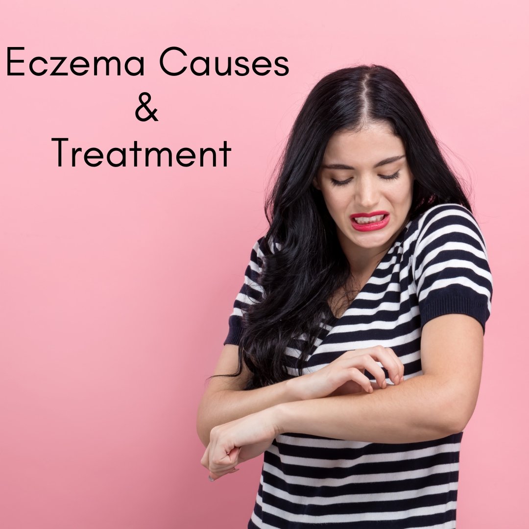 Eczema Causes and Treatment - Nirvana Natural Bliss Luxury Skincare                                                                                                                                                          