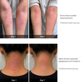 Before and after comparison of skin irritation on arms and neck over 7 days.